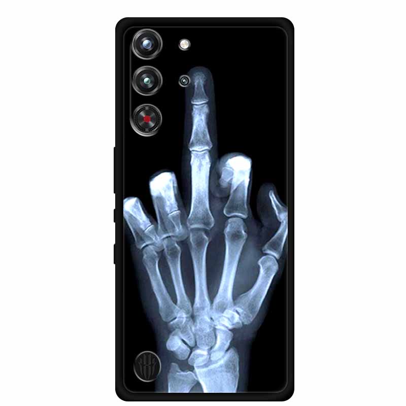 Pour ZTE nubia Red Magic 10 Pr - Redmagic Tablet Accessories avis et prix